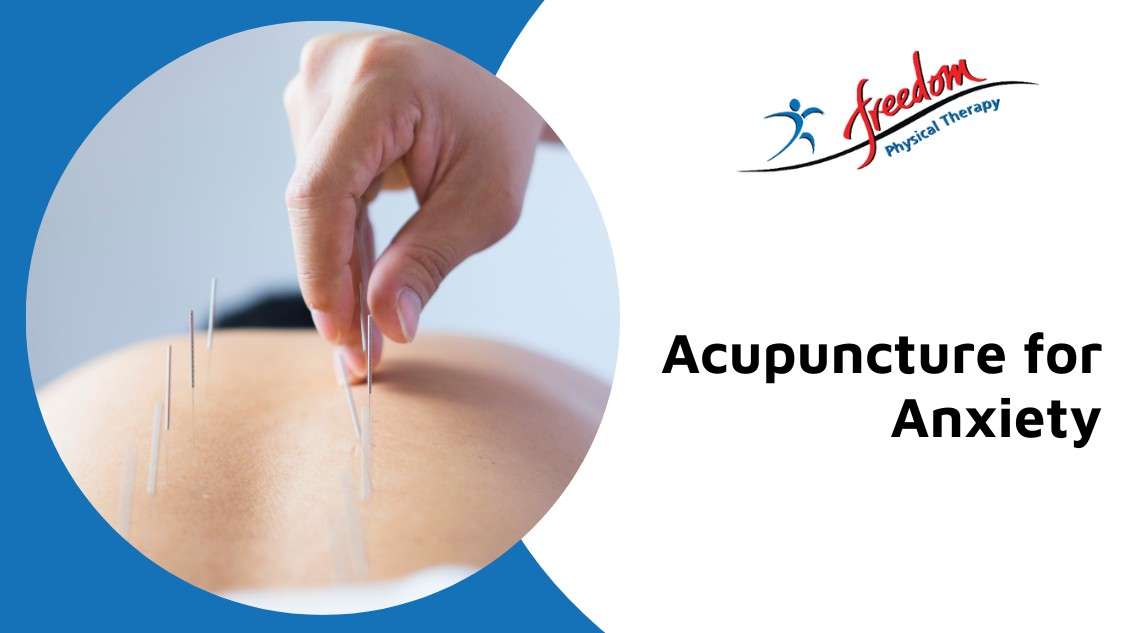 acupuncture for anxiety edmonton south